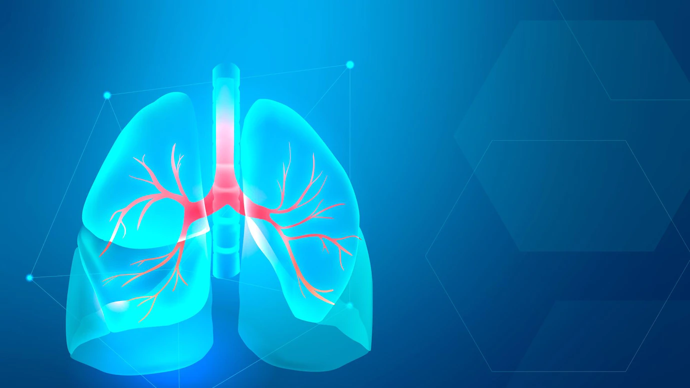Tuberculosis