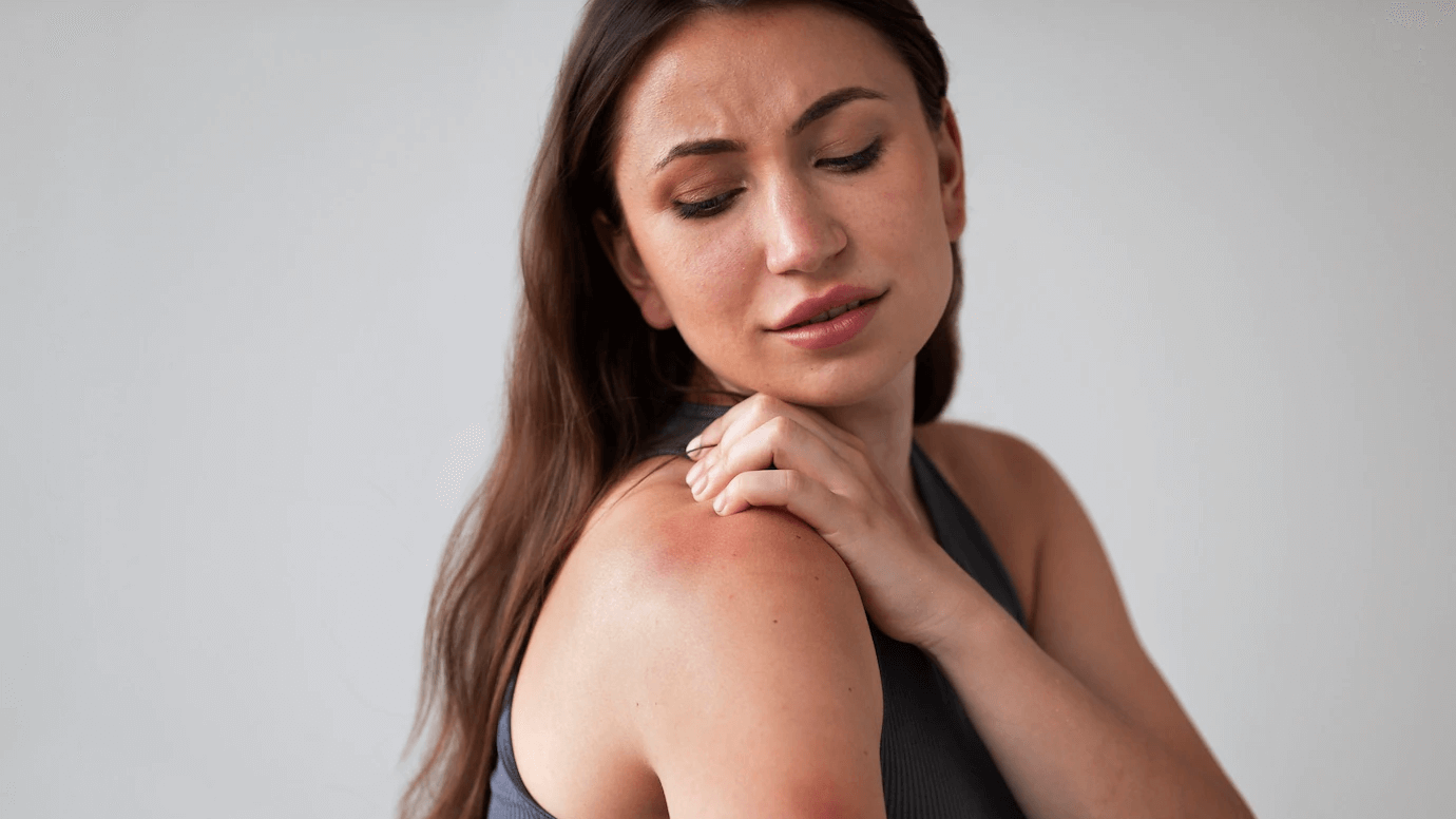 Psoriasis