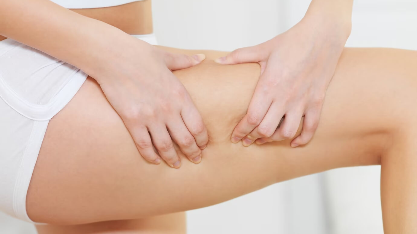 Flebitis